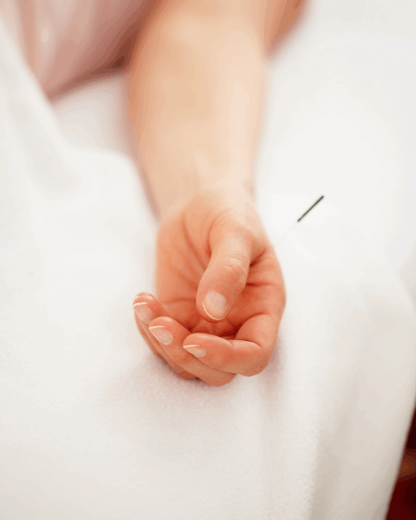 Toronto acupuncture