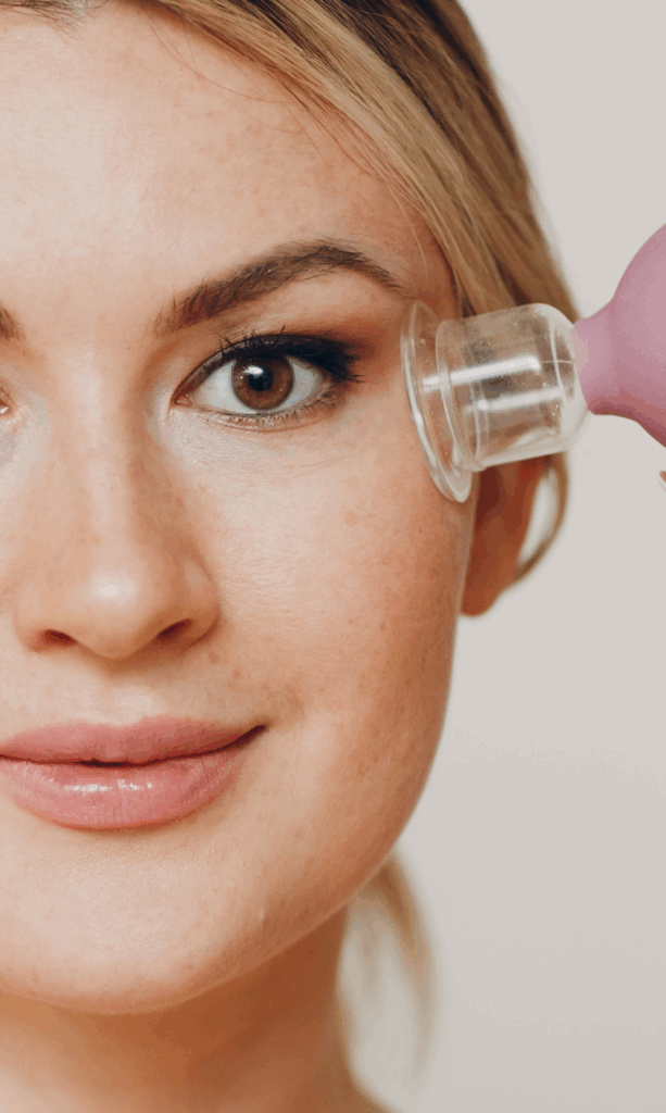 face cupping during cosmetic acupuncture in Toronto wellness clinic